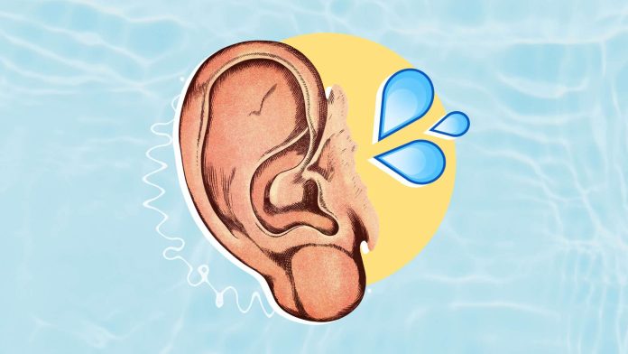 Dealing with Water in the Ear: Causes, Prevention, and Remedies